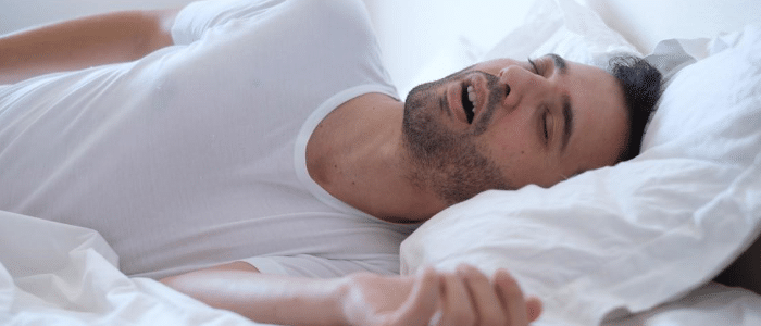 Apneia Obstrutiva do Sono